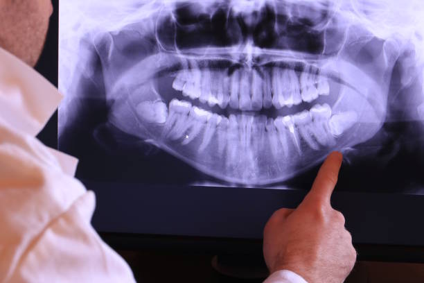 Best Emergency Dental Care for Broken or Chipped Teeth in Hutchins, TX