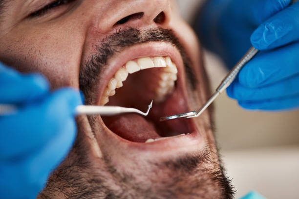 Best Weekend Emergency Dentist in Hutchins, TX